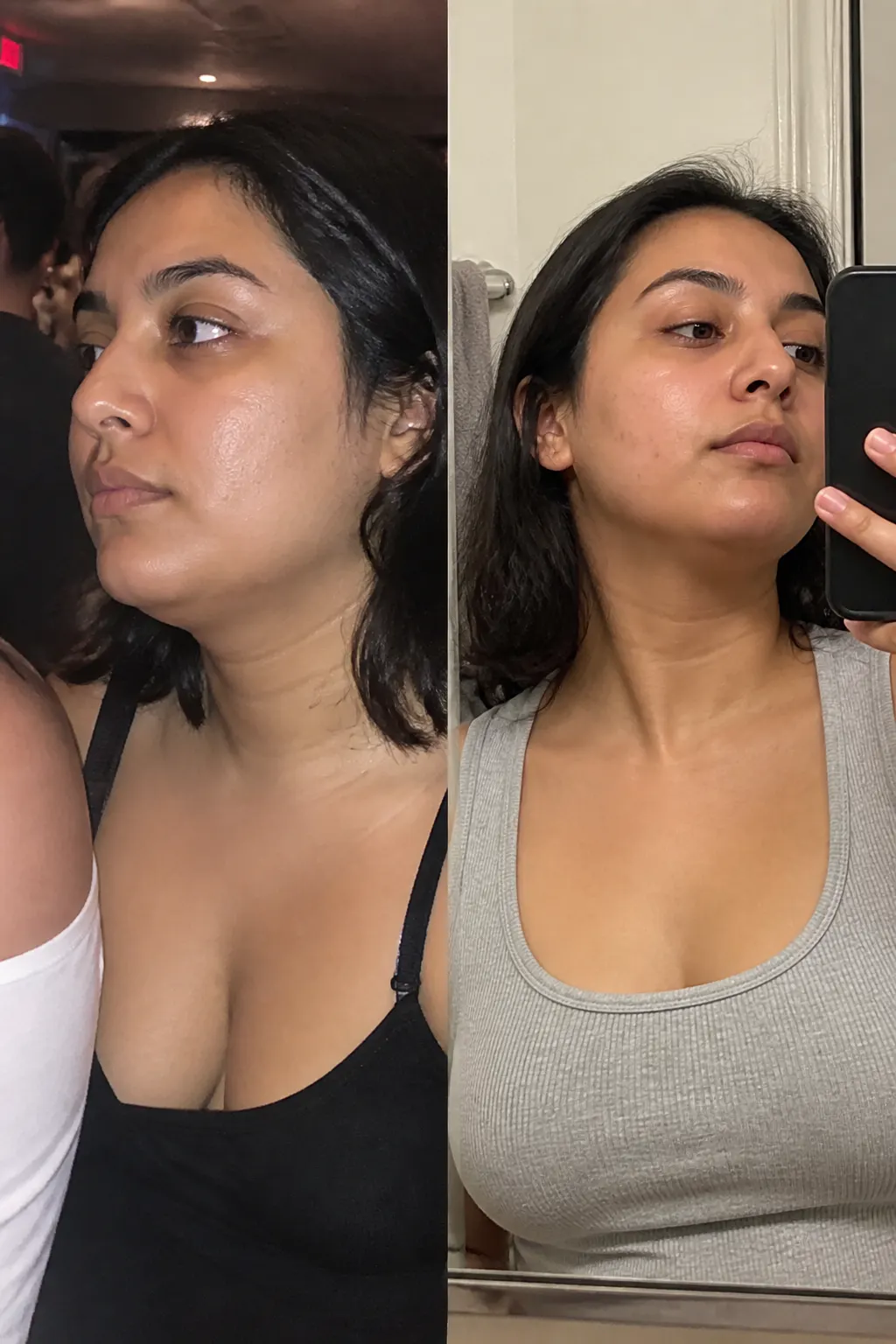 Before and after - Karen M.