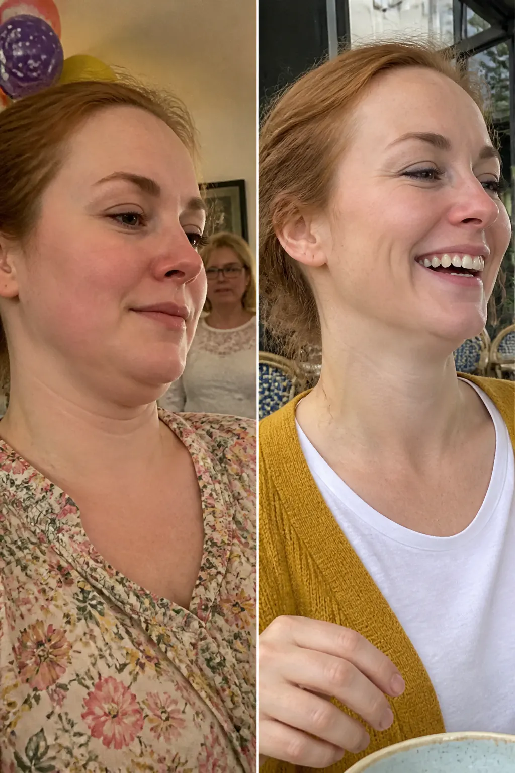 Before and after - Yvonne T.