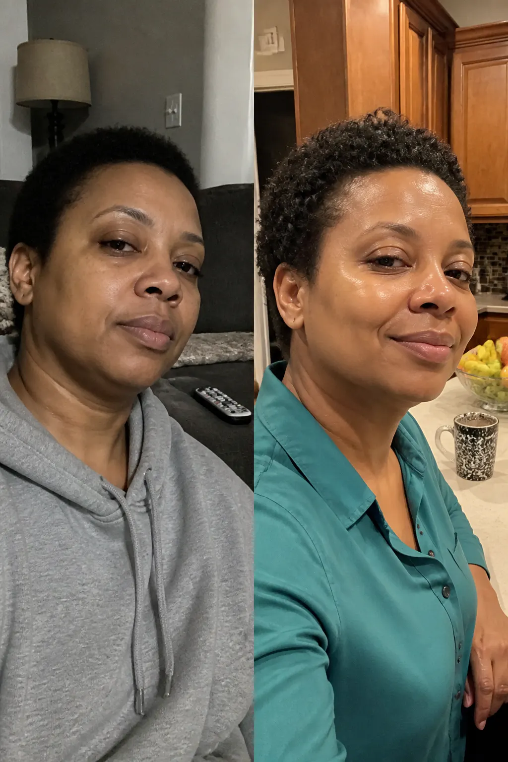 Before and after - Priya S.