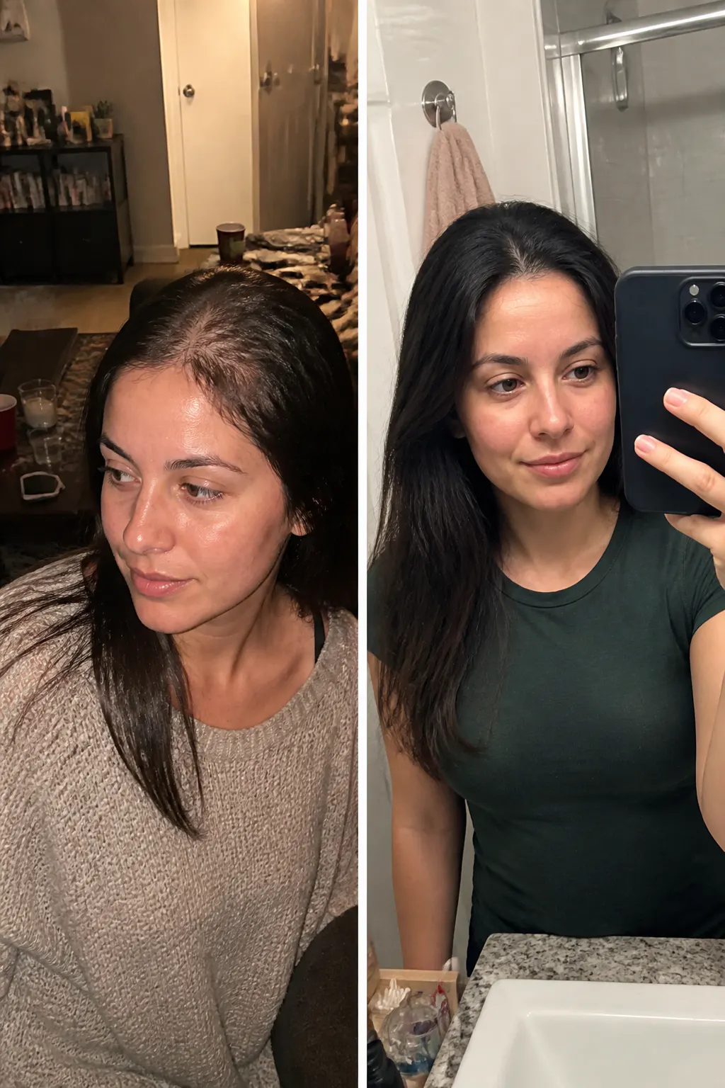 Before and after using Ventra hair vitamins