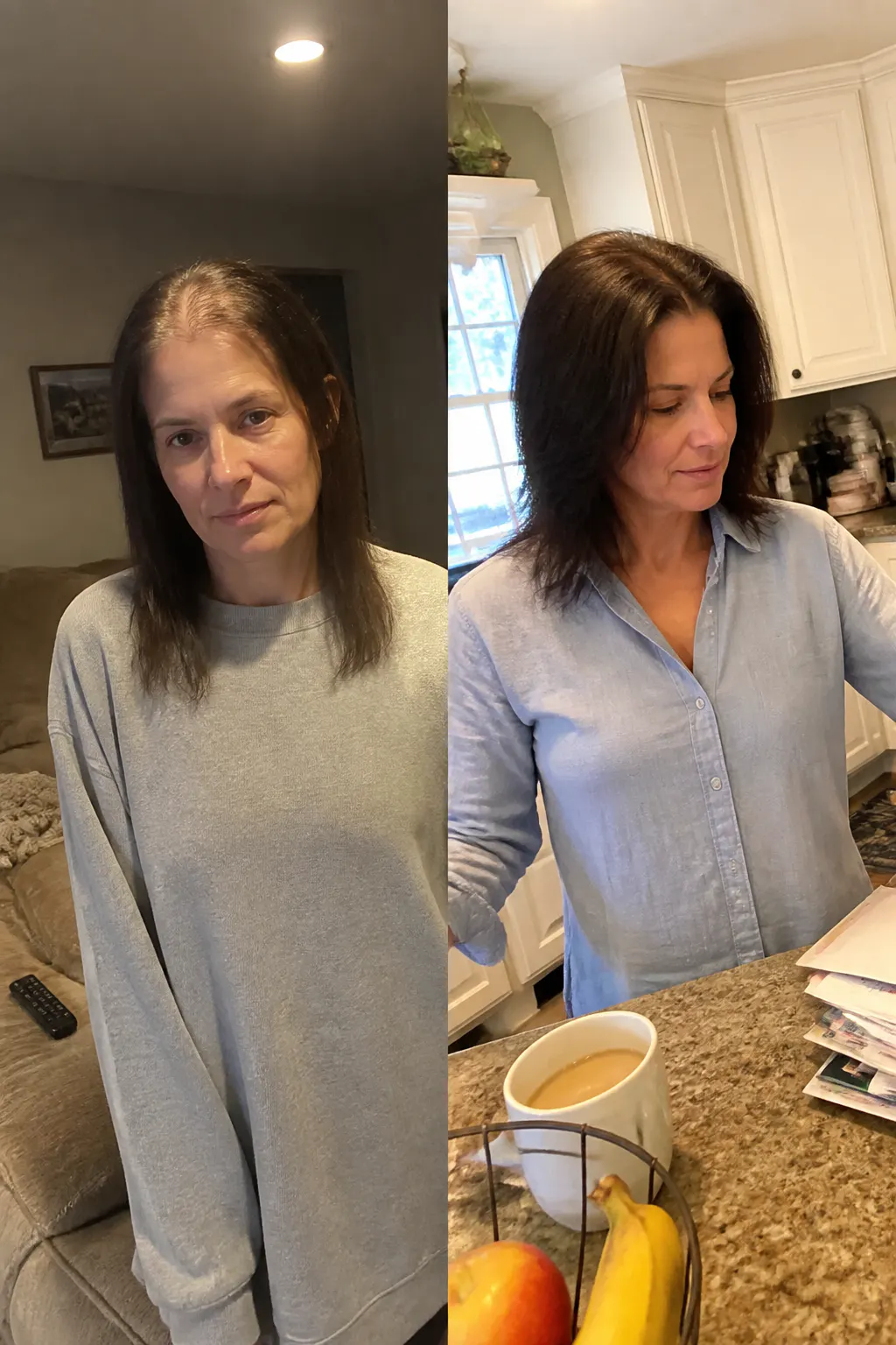 Before and after using Ventra hair vitamins