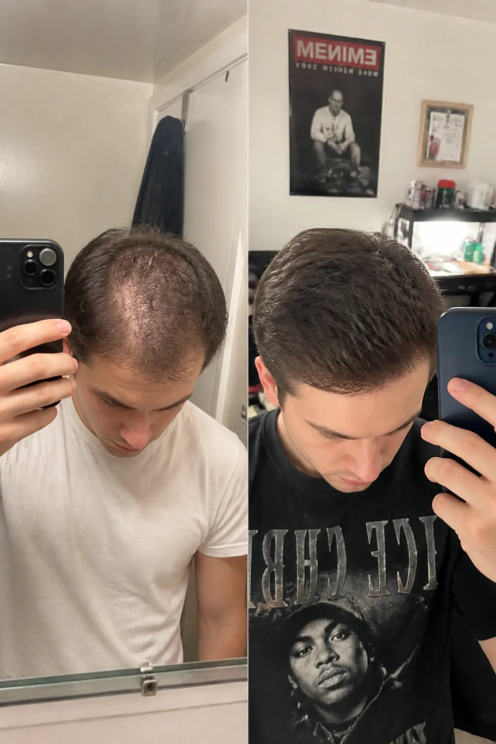 Before and after scalp result - Andre, 38
