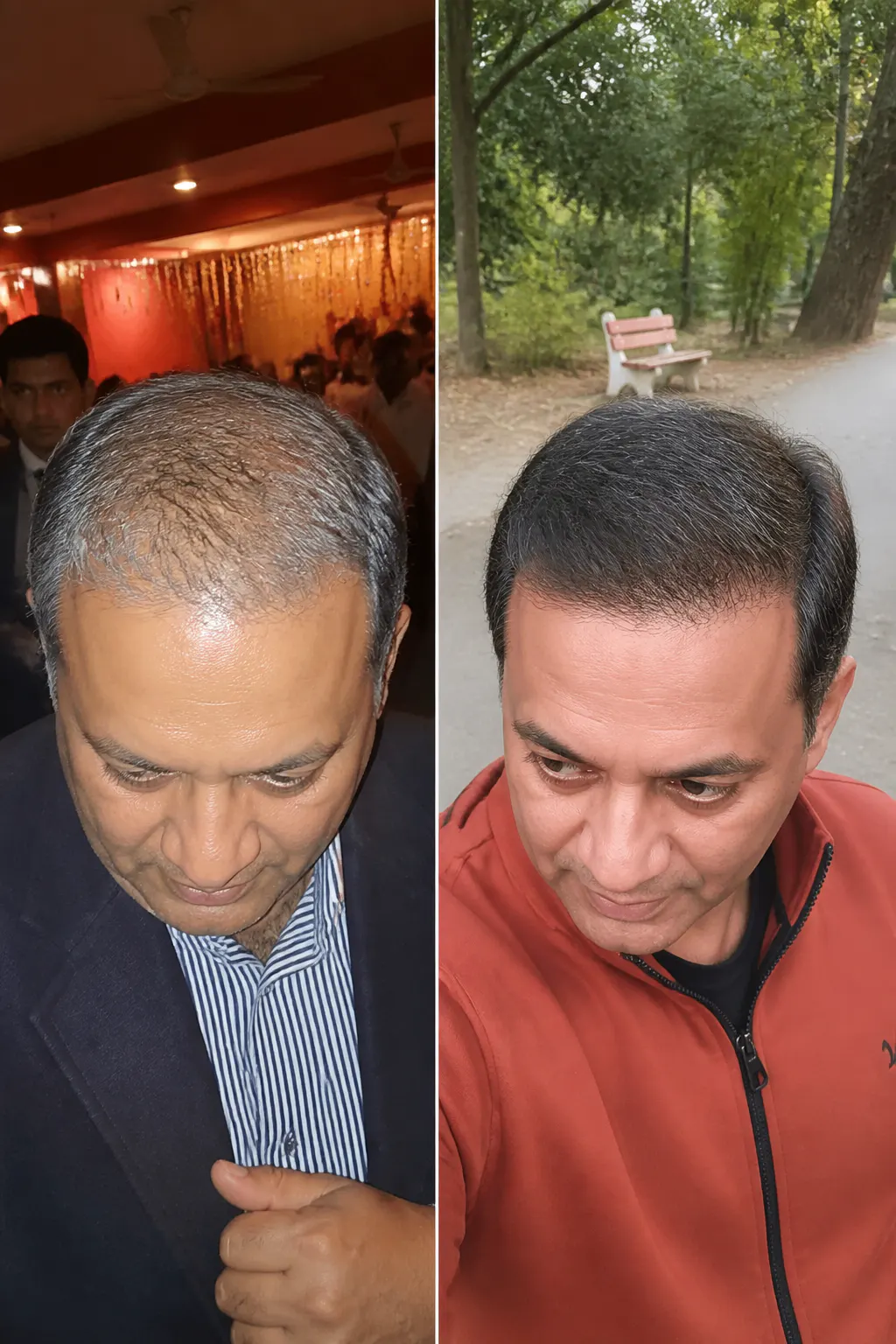 Before and after scalp result - Chris, 41