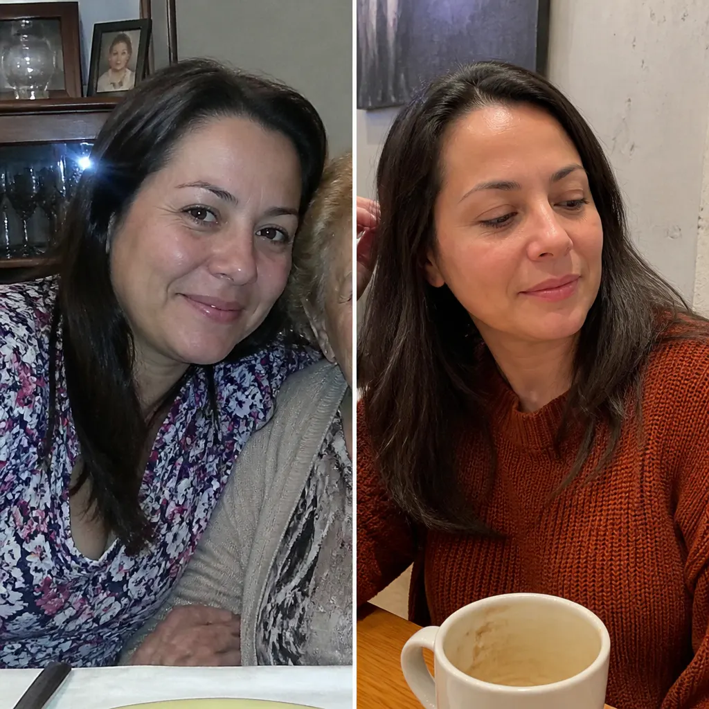 Before and after - Priya S.