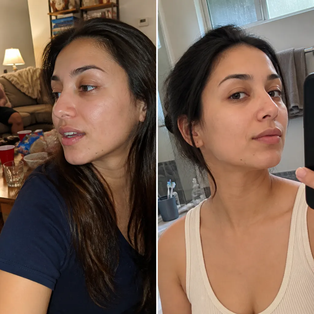 Before and after result - Marisa