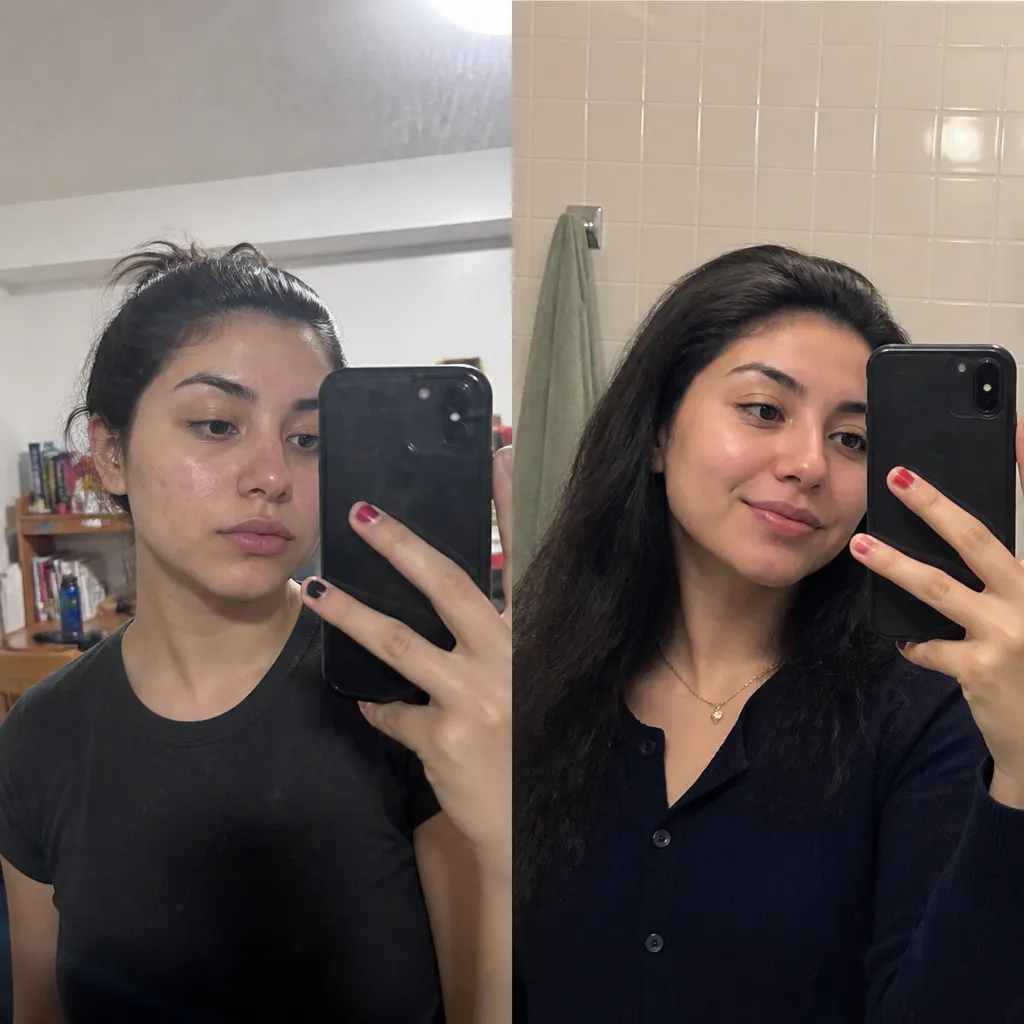 Before and after - Lena T., 39