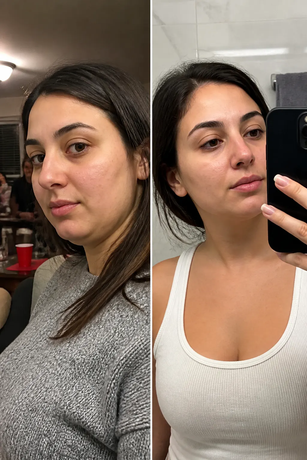 Before and after - Renata M.
