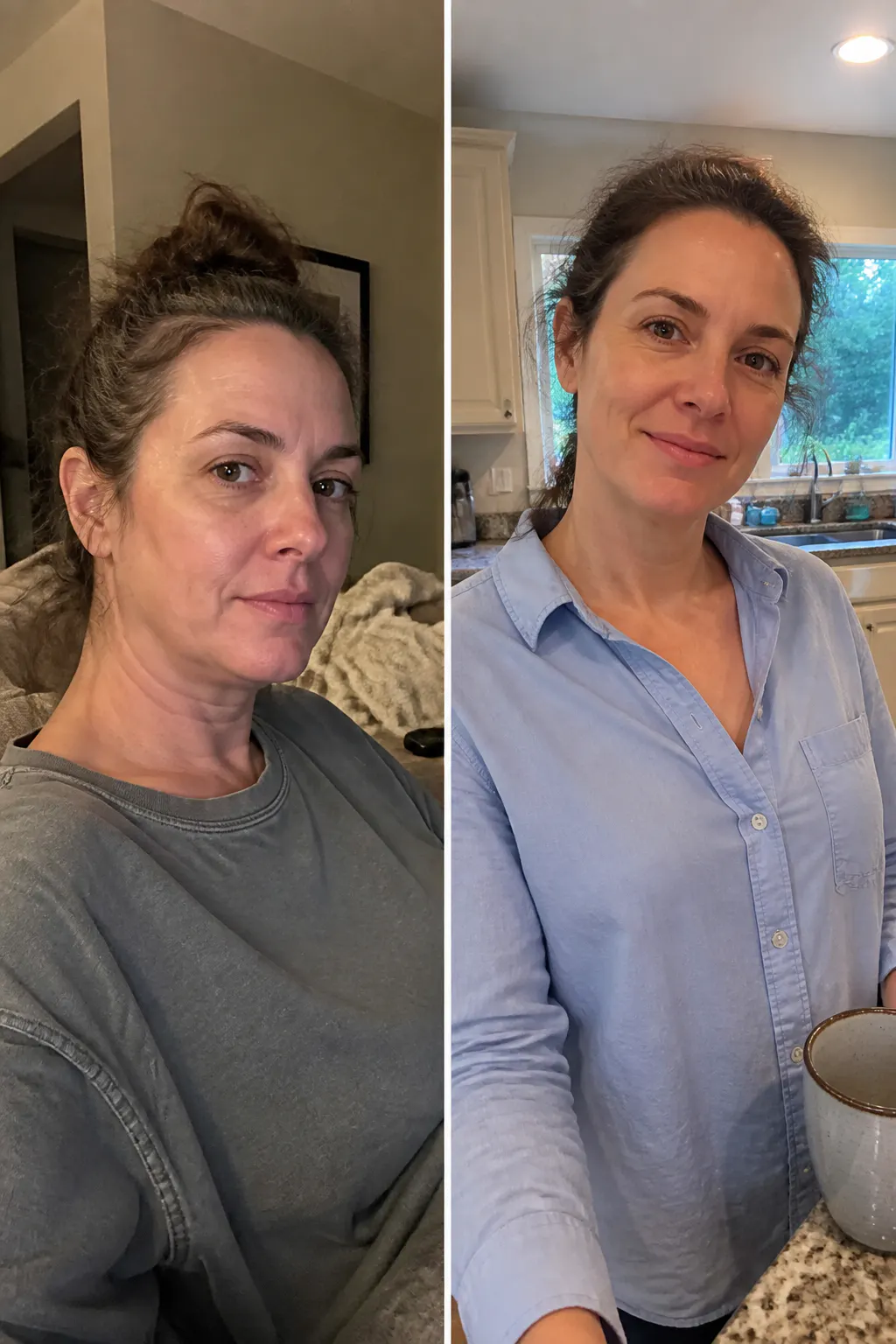 Before and after - Priya S.