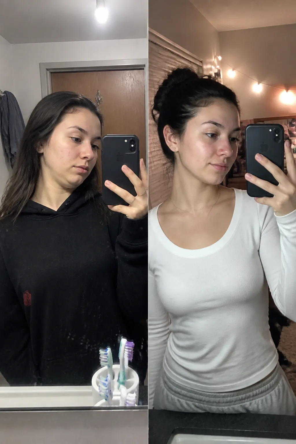 Before and after - Camille T.