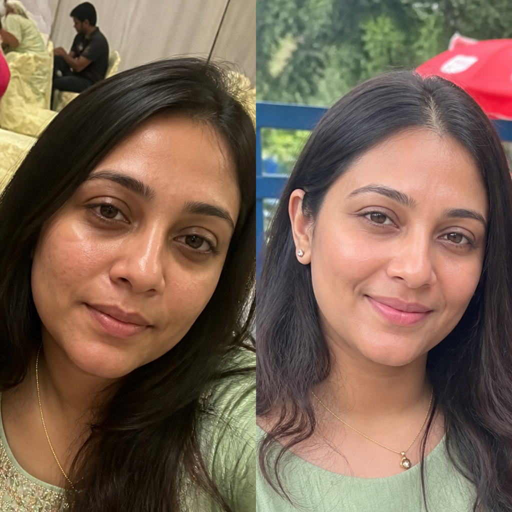 Before and after under-eye result - Priya R. - Using 5 days