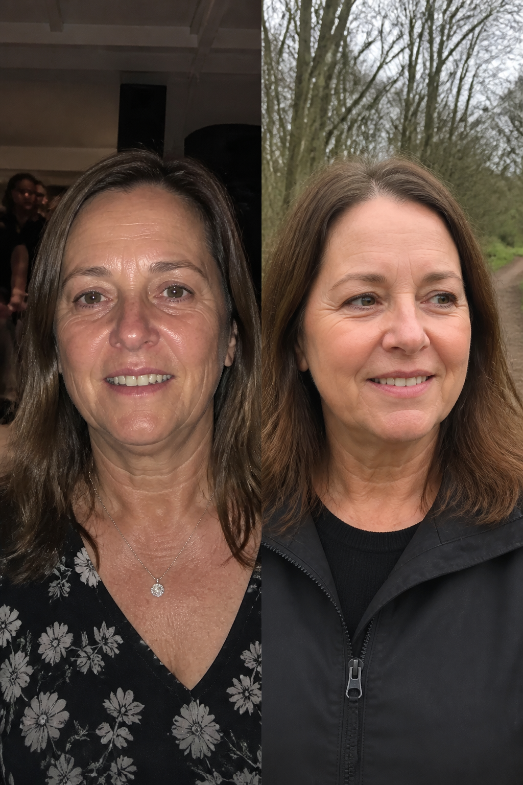 Before and after - Sara B.
