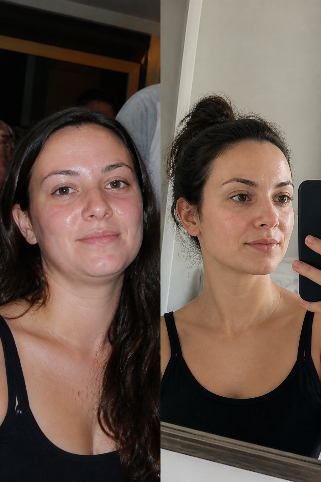 Before and after - Carol M.