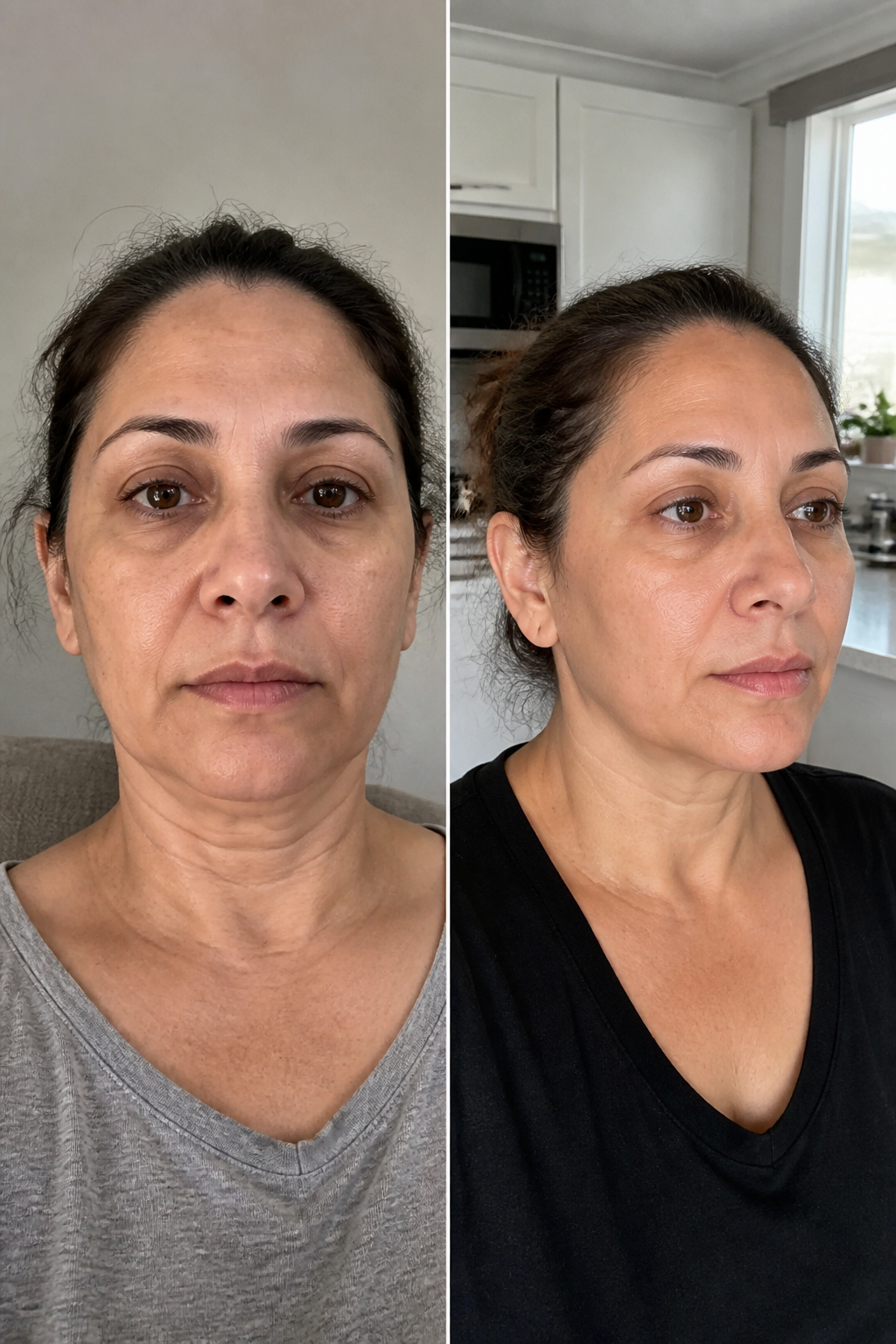 Before and after - Yolanda P.