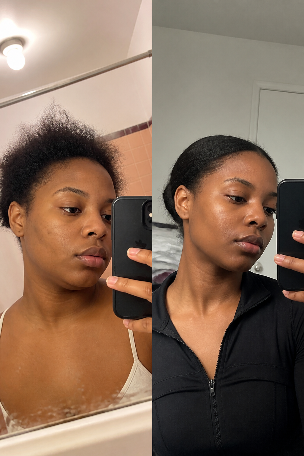 Before and after - Maria S.