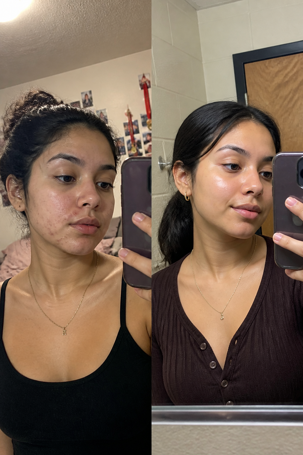 Before and after using SeoulGlow - Sofia M.
