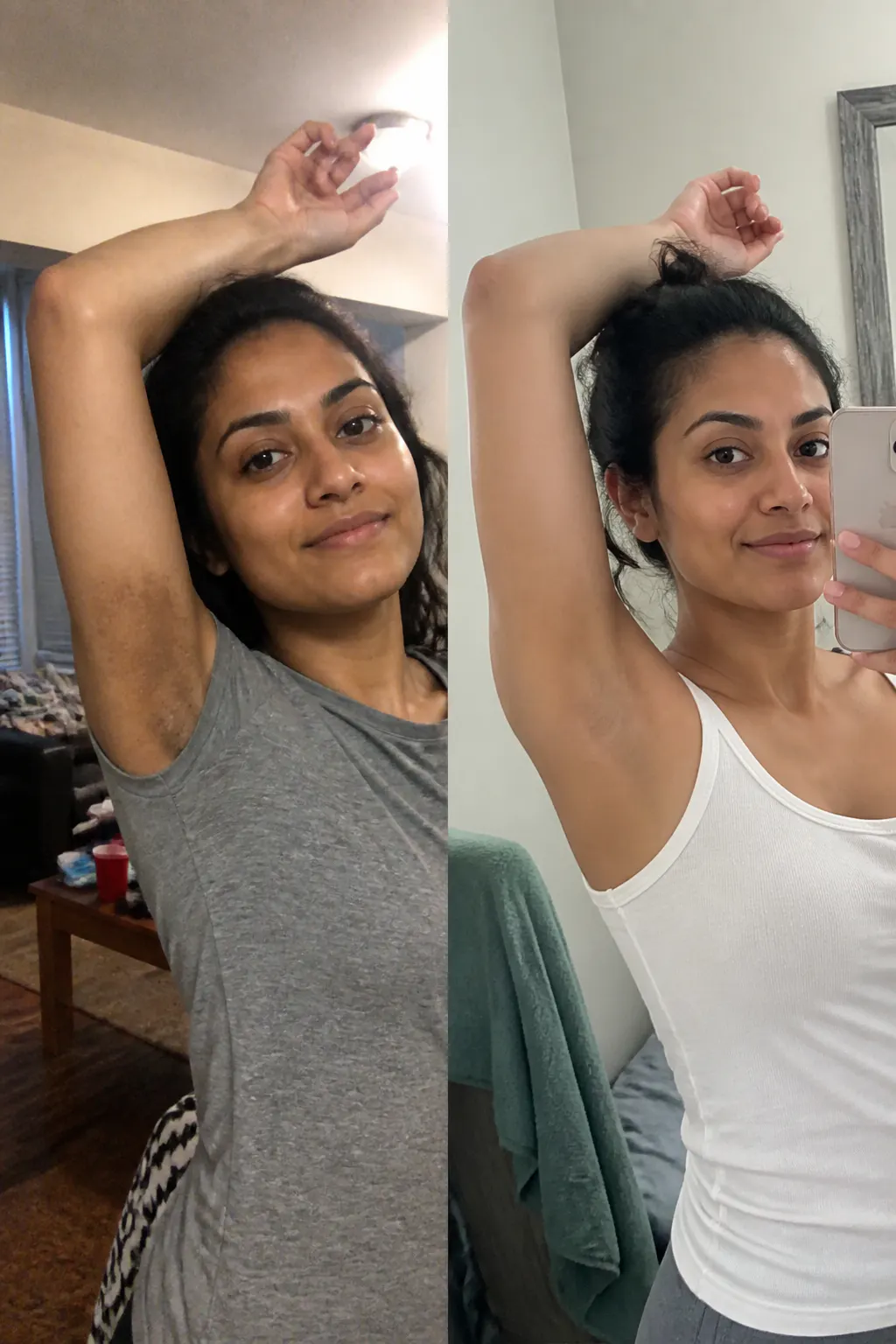 Before and after - Amara T.