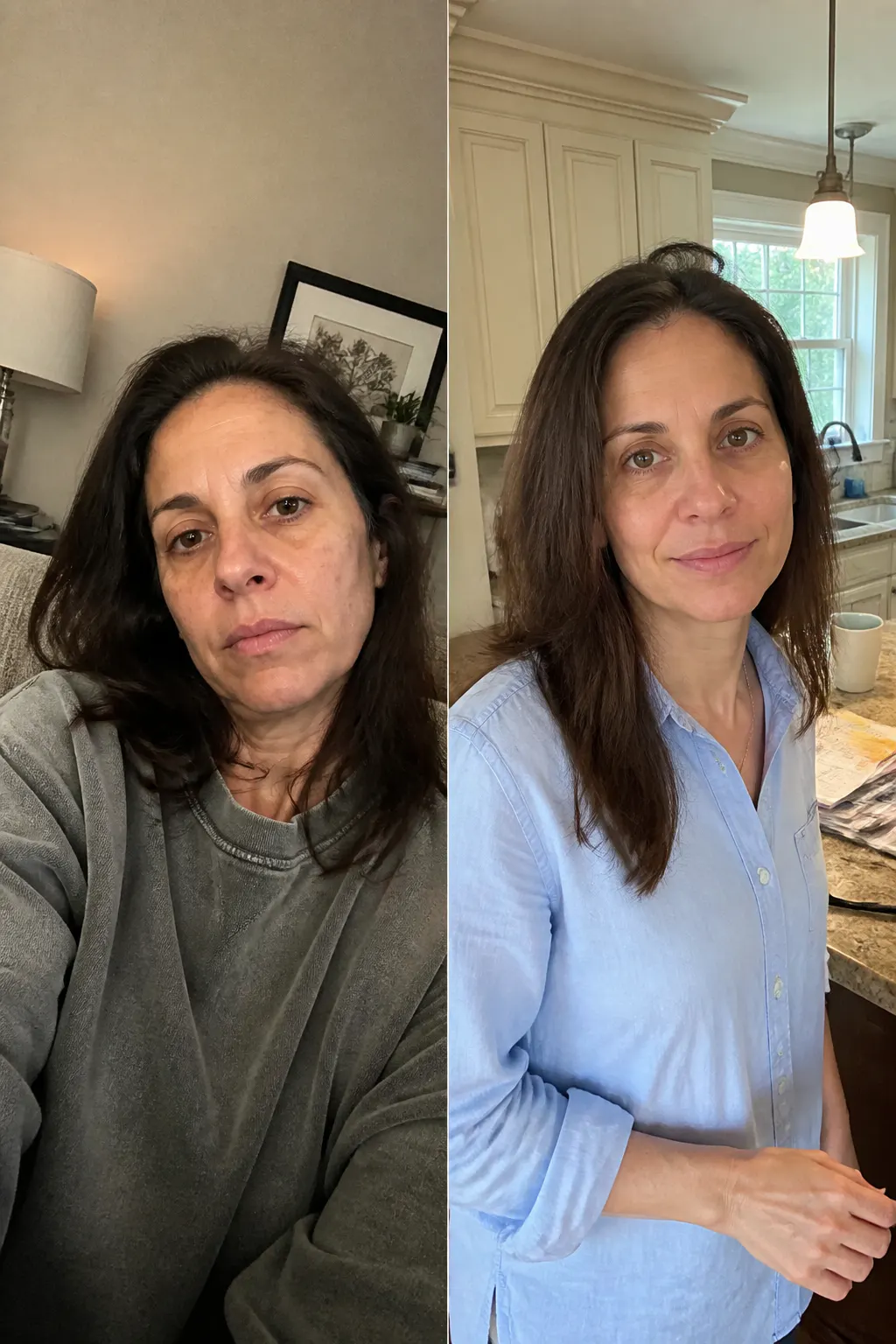 Before and after - Denise W.