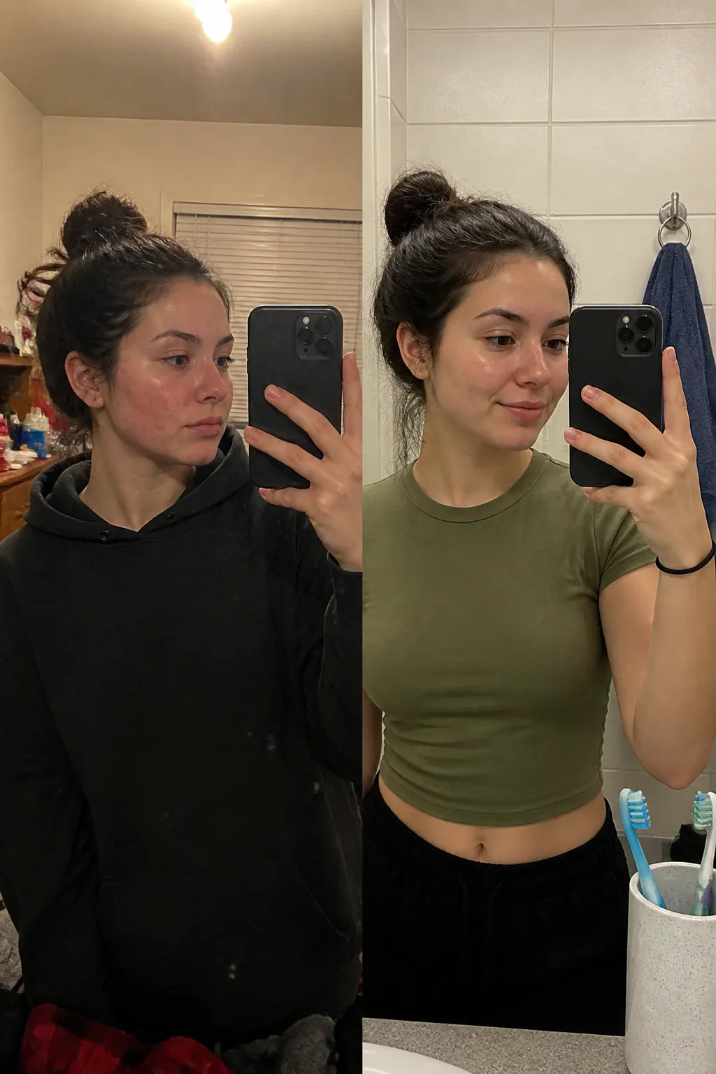 Before and after - Lauren M.