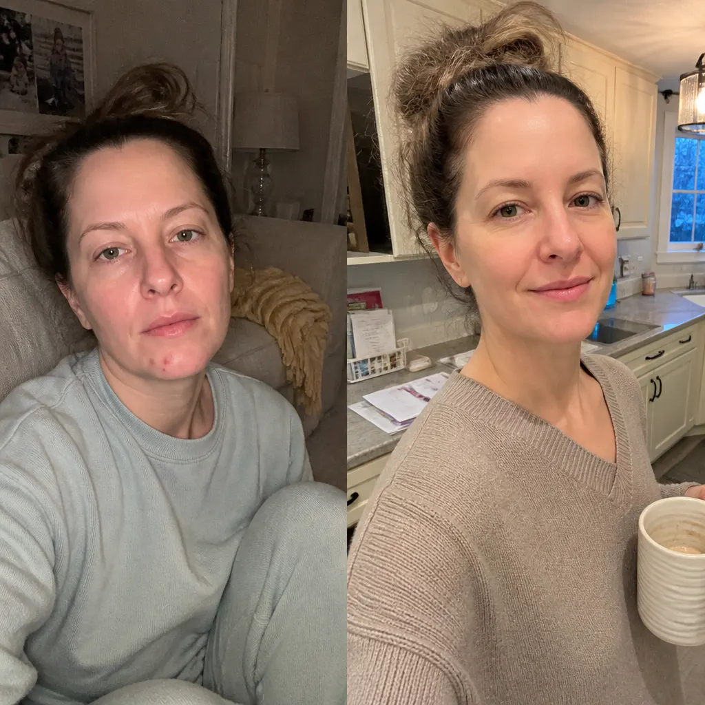 Before and after - Priya N.